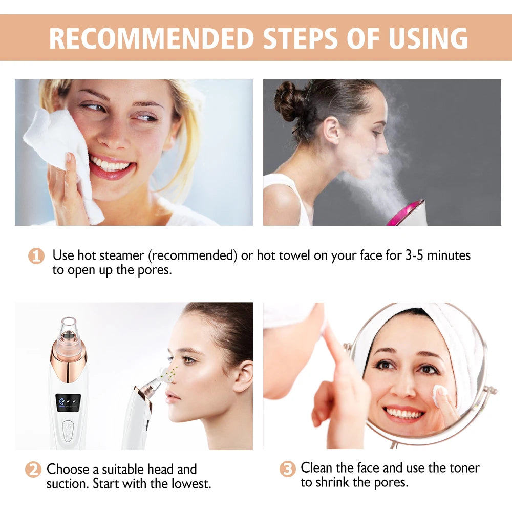 Novara Beauty Blackhead Remover - 65KPa Vacuum Pore Cleaner