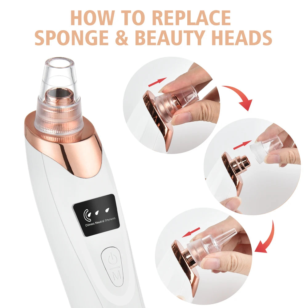 Novara Beauty Blackhead Remover - 65KPa Vacuum Pore Cleaner