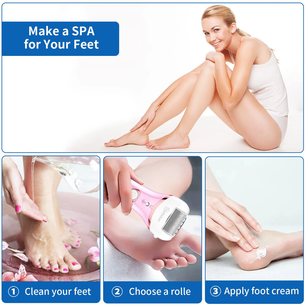 Novara Beauty Electric Foot File - 3 Speed Callus Remover & Pedicure Tool