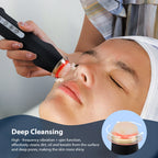 Novara Beauty Oxygen Bubble Pen - CO2 Facial Skin Care Device