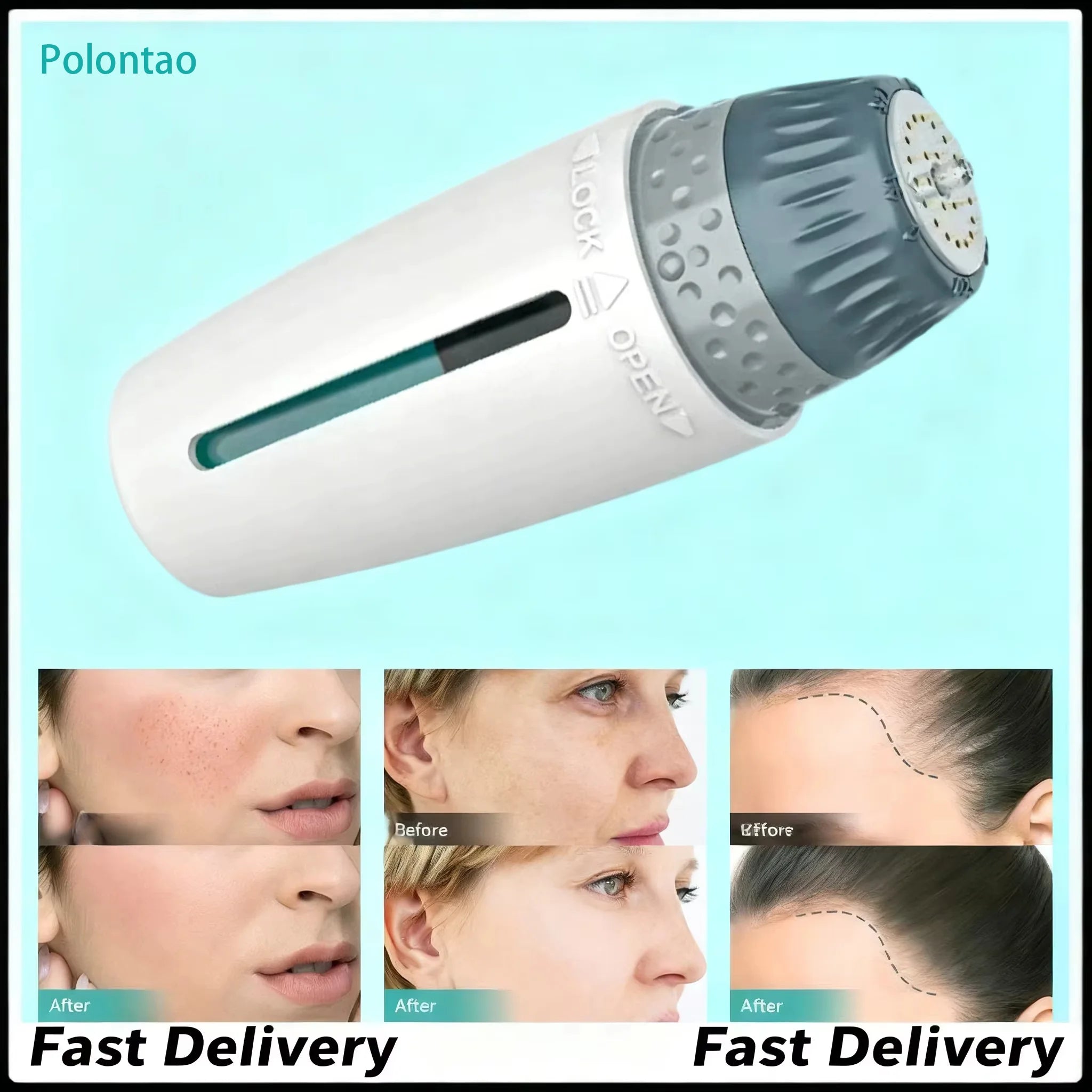 Novara Beauty Derma Stamp Microneedle - 0.25mm Skin Care Tool
