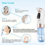 Novara Beauty USB Blackhead Remover - Gentle Pore Cleaning Device White