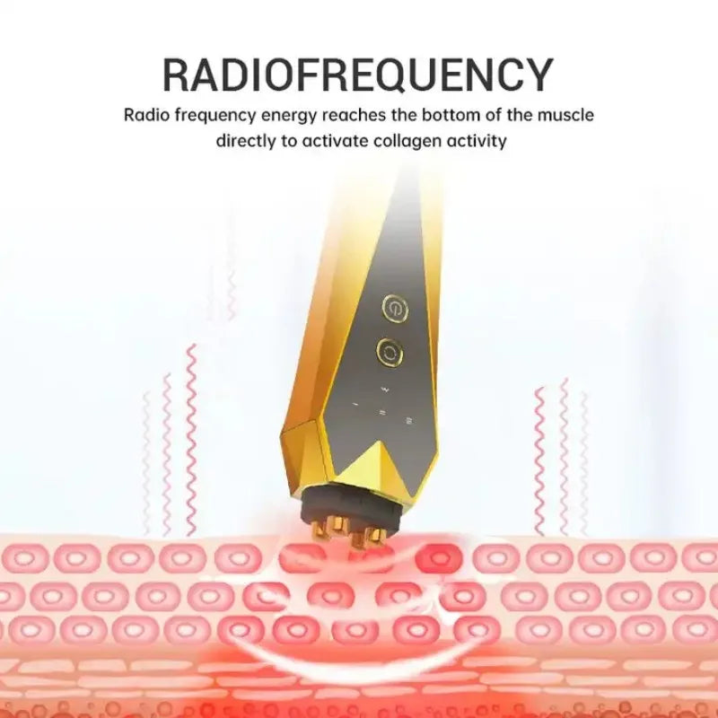 Novara Beauty Multi-RF Skin Tightening Device - Anti-Aging Wrinkle Remover