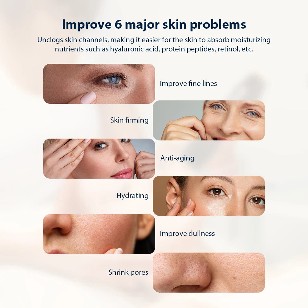 Novara Beauty Oxygen Bubble Pen - CO2 Facial Skin Care Device